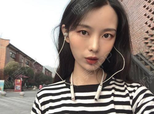 娱乐圈吃瓜水母头